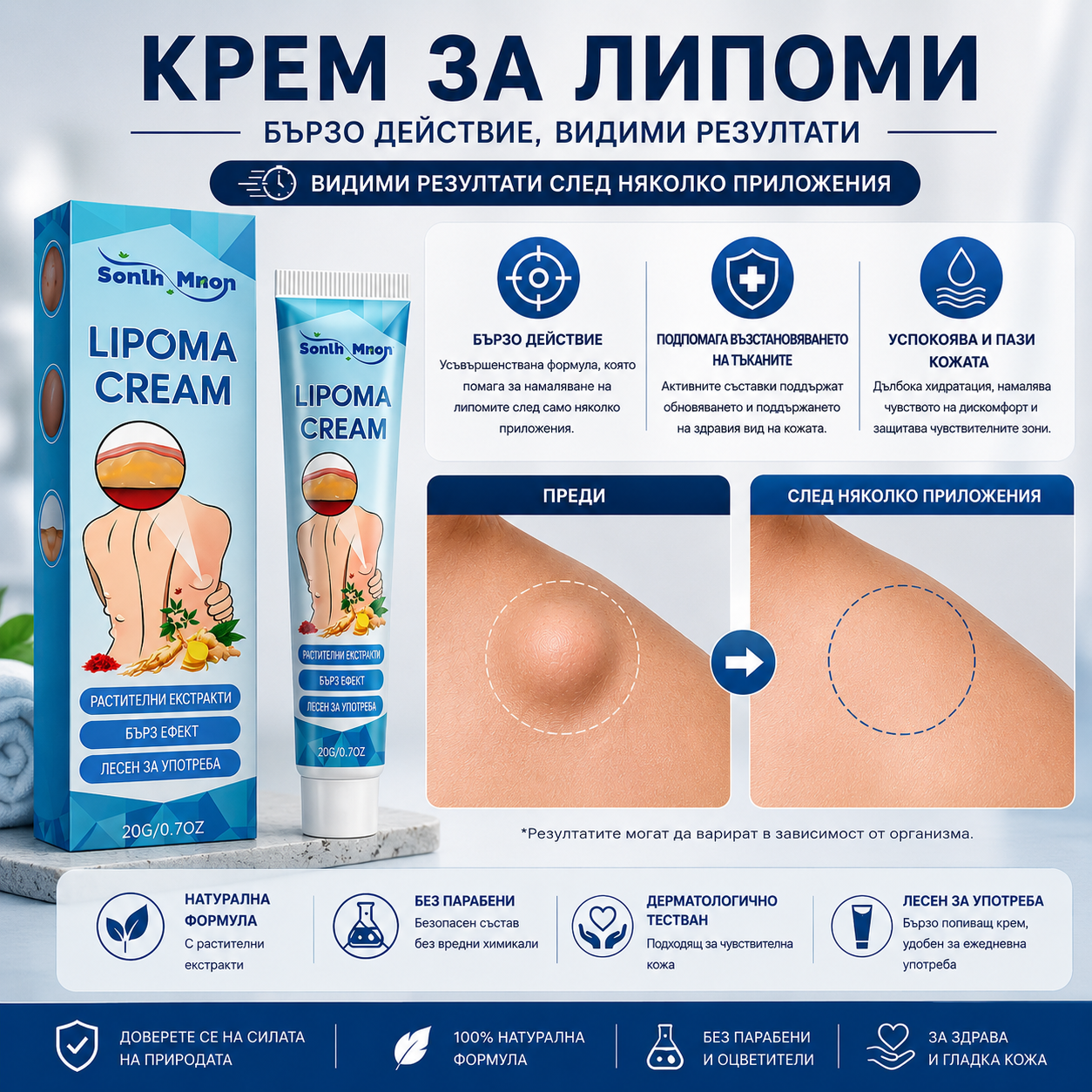 LipoDerm Крем за липоми